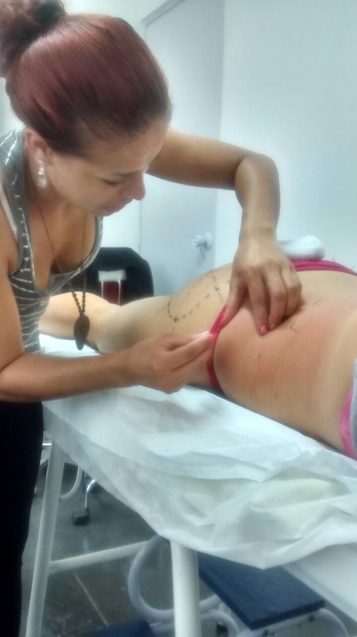 Onde Encontrar Clínica de Tratamento Estético na Vila Assunção - Clínica de Tratamento Estético
