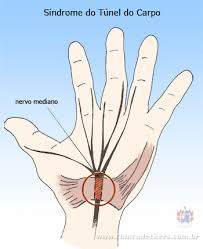 Ortopedia de Mão na Bairro Campestre - Ortopedia e Traumatologia