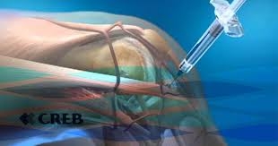 Quanto Custa Clínica Ortopédica de Tratamento de Ombro e Joelho na Vila Alpina - Ortopedia e Traumatologia
