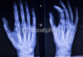 Quanto Custa Ortopedia de Mão em Figueiras - Clínica de Ortopedia e Traumatologia