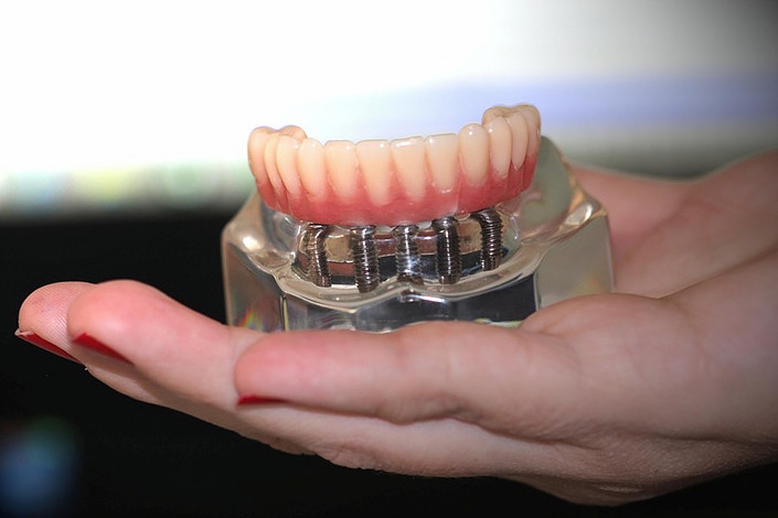 Spa Odontológicos no Jardim Santo André - Tratamento de Raspagem nos Dentes