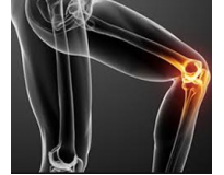 ortopedista especialista em joelho no Sítio dos Vianas